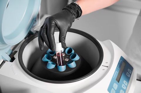 Lab Centrifuge Machines Explained: Types, Working Principle & Applications